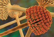 Managing Aflatoxin M1 levels in Milk Demands Coordinated and Integrated Efforts