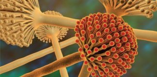 Managing Aflatoxin M1 levels in Milk Demands Coordinated and Integrated Efforts