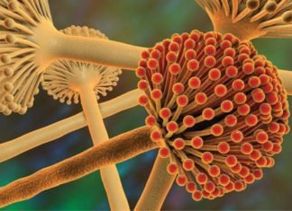 Managing Aflatoxin M1 levels in Milk Demands Coordinated and Integrated Efforts