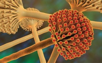 Managing Aflatoxin M1 levels in Milk Demands Coordinated and Integrated Efforts