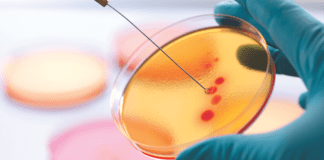 Report: Anti-microbial resistance analysis in Indian Aquaculture