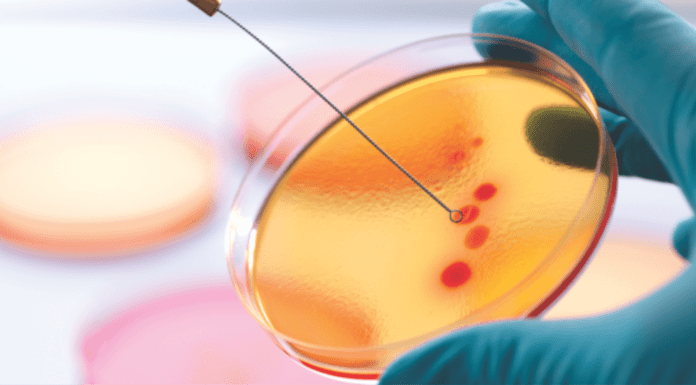 Report: Anti-microbial resistance analysis in Indian Aquaculture