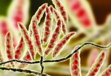 Integrated Approach for Mycotoxin and Gut Health Management in Poultry