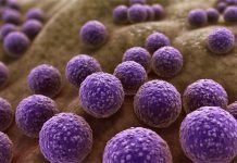 The AMR Dilemma: Experts’ Opinions and Insights