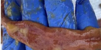 An Effective Strategy to Control Necrotic Enteritis in Monsoon Season