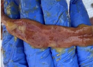 An Effective Strategy to Control Necrotic Enteritis in Monsoon Season